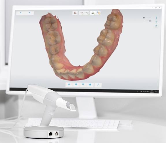 Intraoral smile images on chairside computer